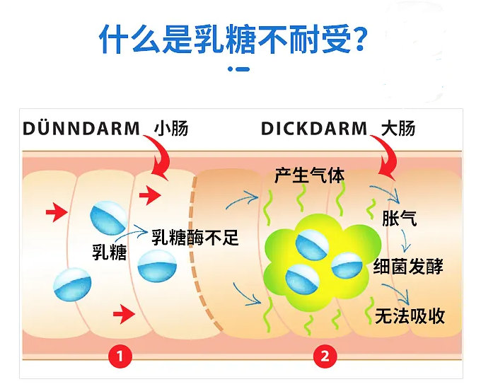 乳糖不耐受,乳糖不耐受的解决方法,乳糖不耐受的症状