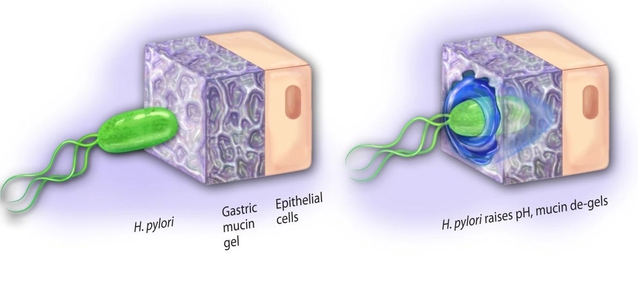 幽门螺旋杆菌，幽门螺杆菌