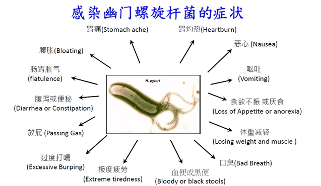 感染幽门螺旋杆菌的症状