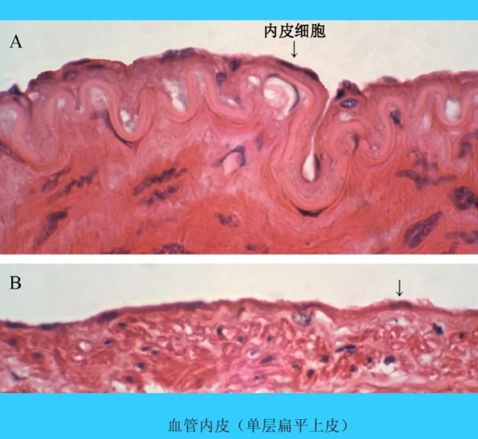 一氧化氮通过多种机制调节血压。